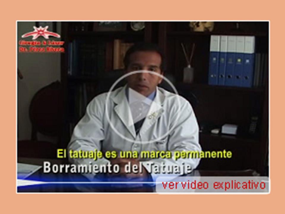 Ahora Videos Explicativos!!